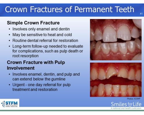 Module 4 Slide 41