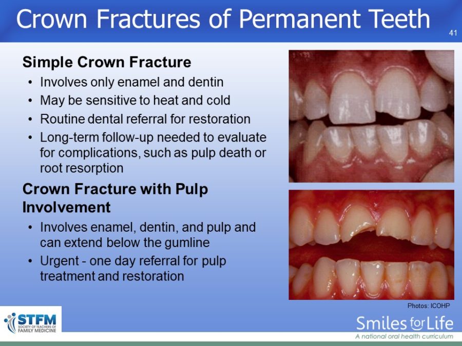 Module 4 Slide 41