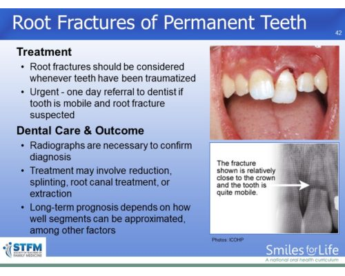 Module 4 Slide 42