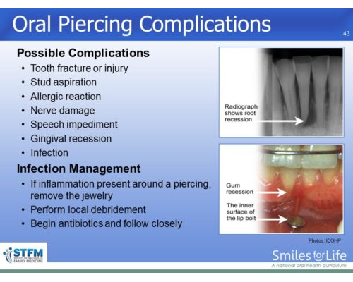 Module 4 Slide 43