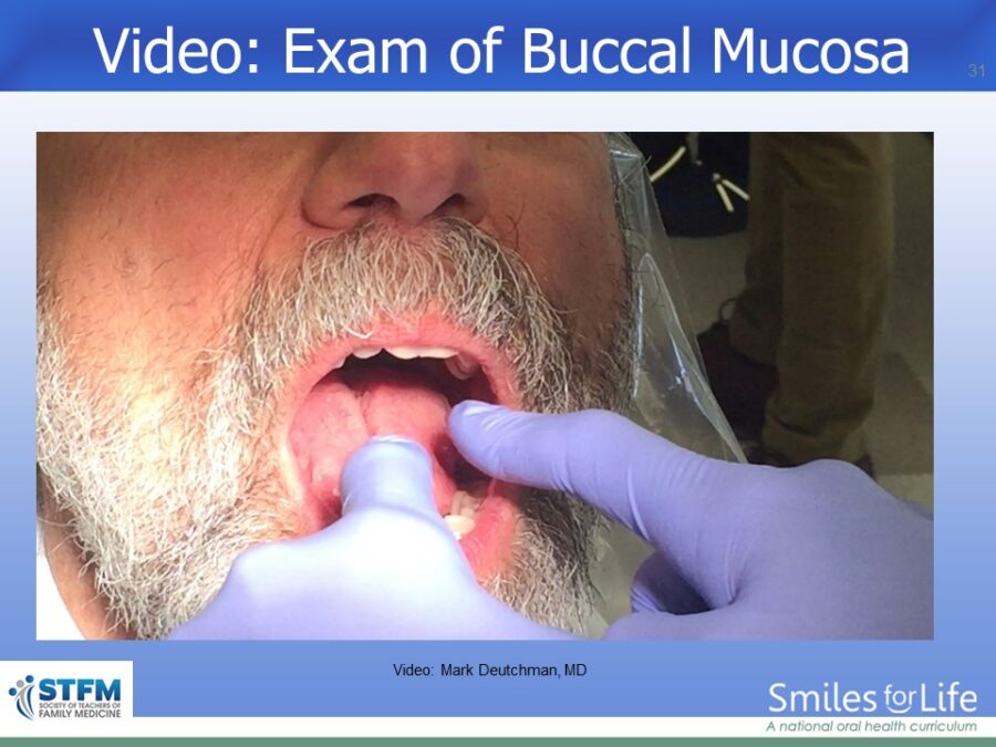 Module 7 Slide 31