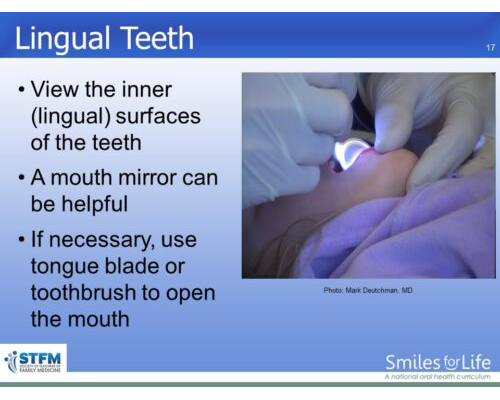 Module 7 Slide 17