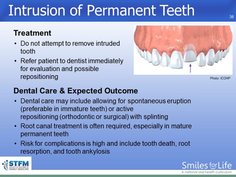 Module 4 Slide 38