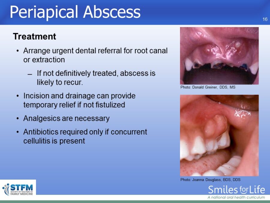 Module 4 Slide 16
