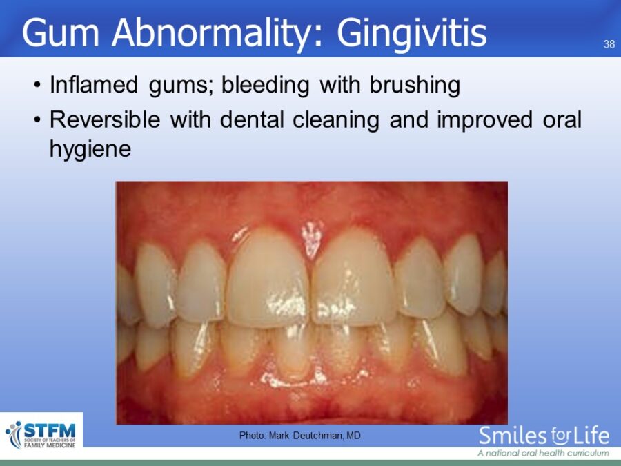 Module 7 Slide 38