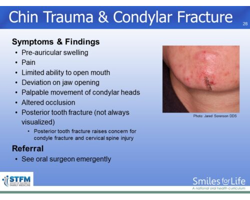 Module 4 Slide 28