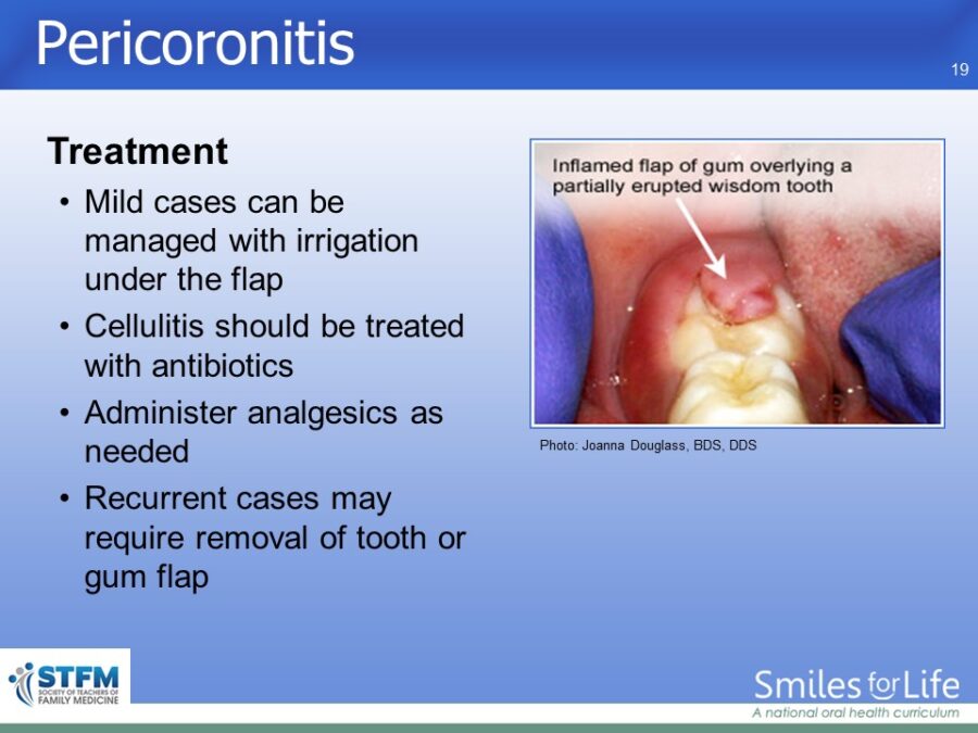 Module 4 Slide 19