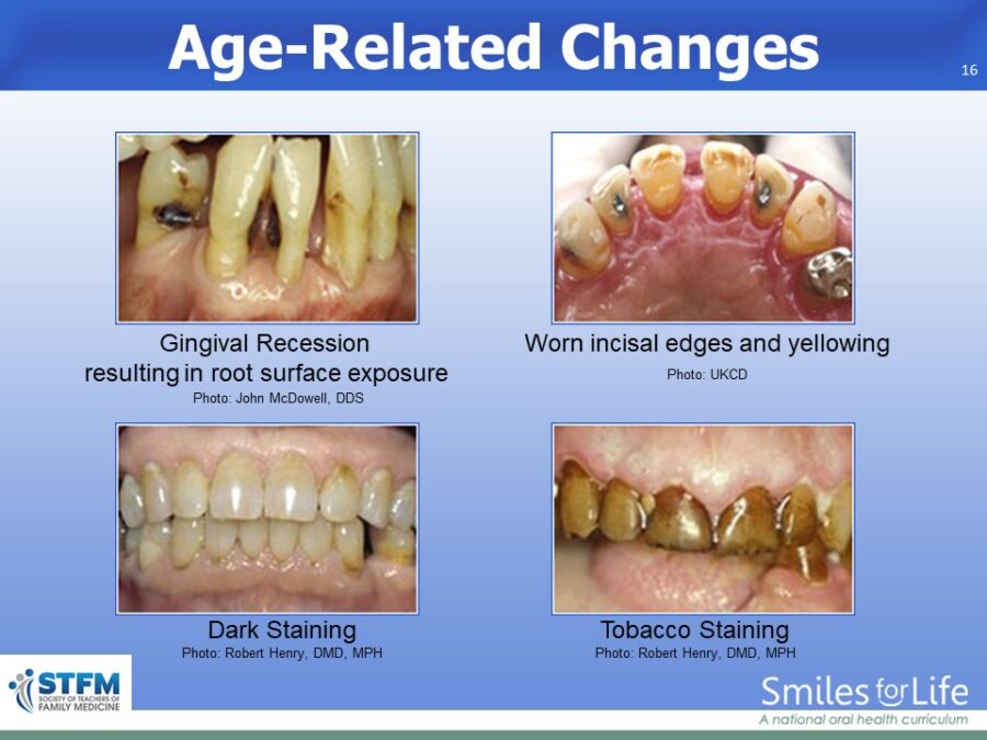 Module 8 Slide 16