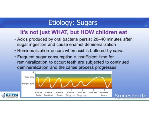 Module 2 Slide 11