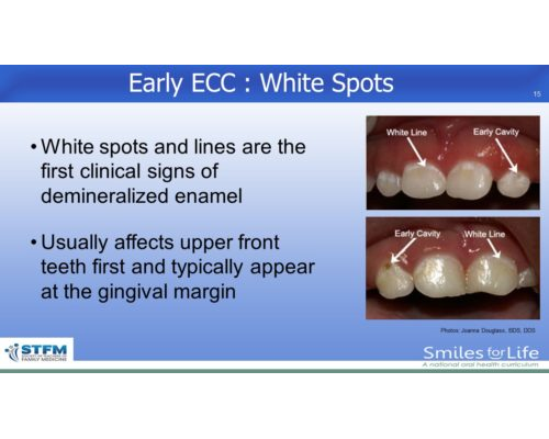 Module 2 Slide 15