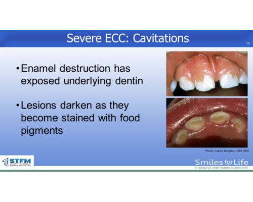 Module 2 Slide 16