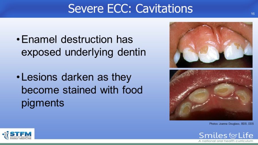 Module 2 Slide 16