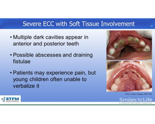 Module 2 Slide 17