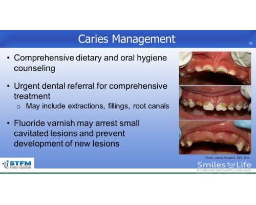 Module 2 Slide 36