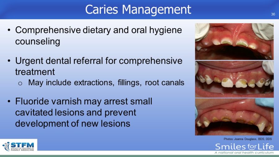 Module 2 Slide 36