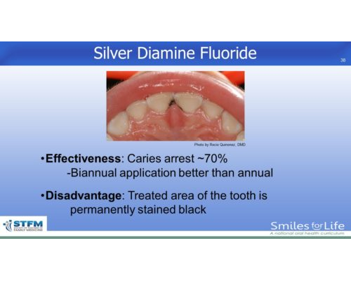 Module 2 Slide 38