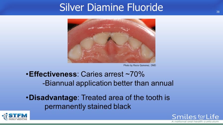 Module 2 Slide 38