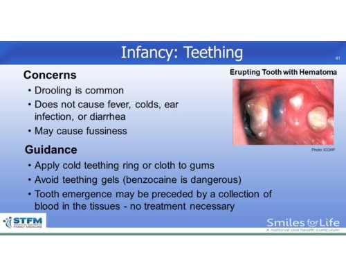 Module 2 Slide 41