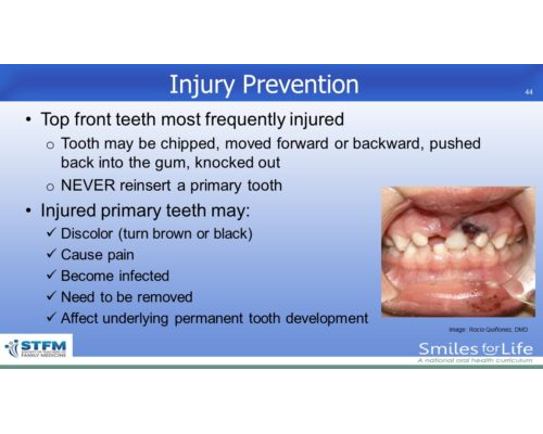 Module 2 Slide 44