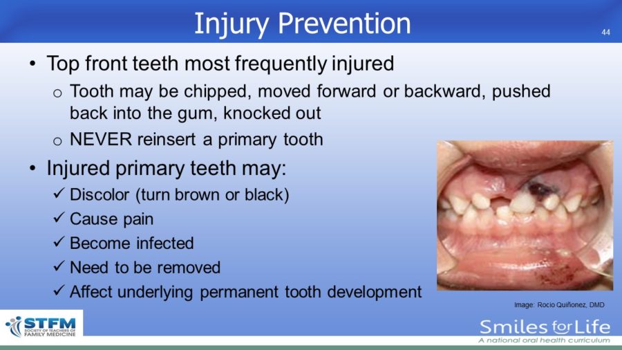 Module 2 Slide 44