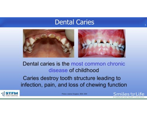 Module 2 Slide 5