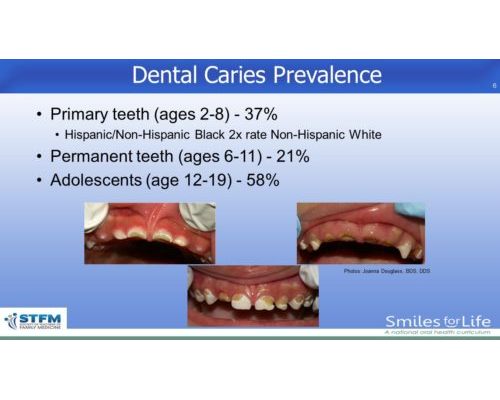 Module 2 Slide 6