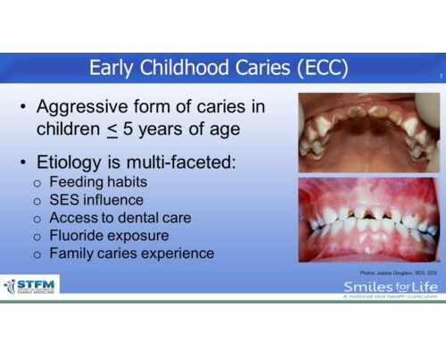 Module 2 Slide 7