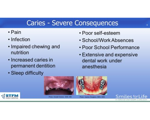 Module 2 Slide 8