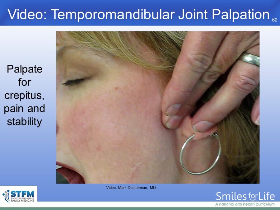 Module 7 Slide 60
