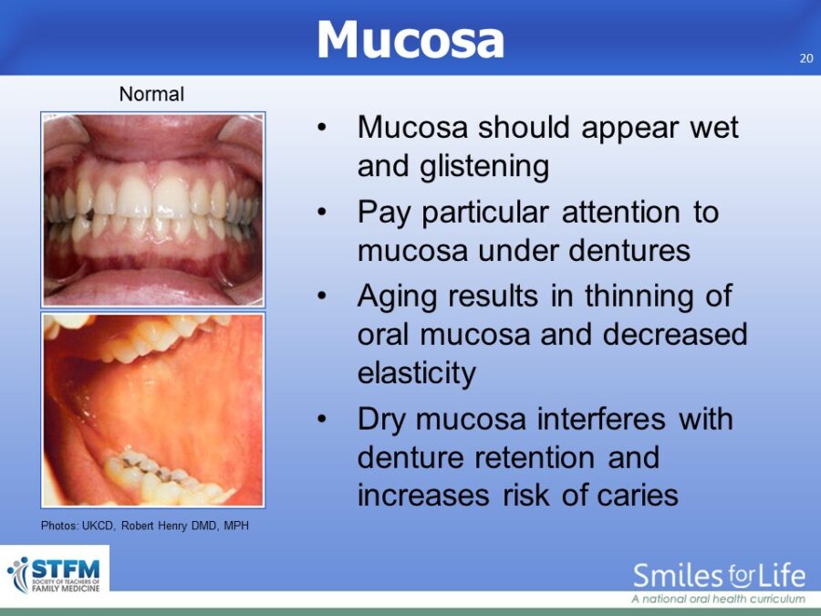 Module 8 Slide 20