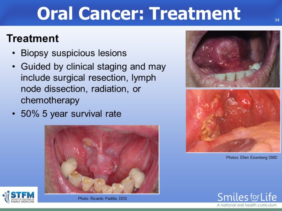 Module 8 Slide 34