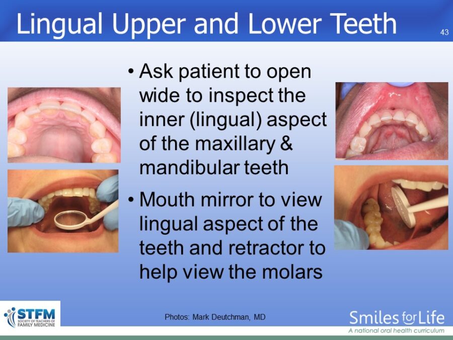 Module 7 Slide 43