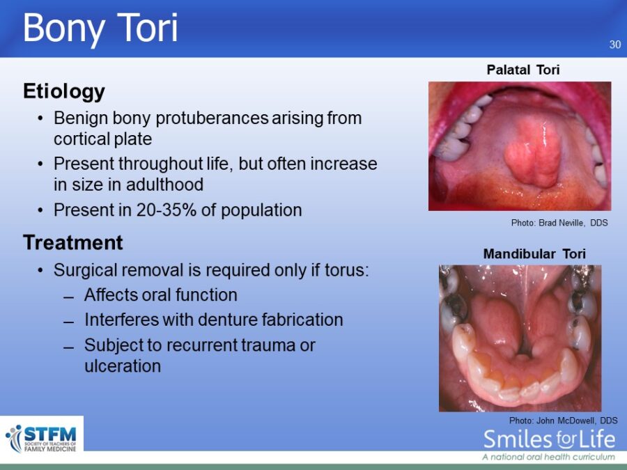 Module 3 Slide 30