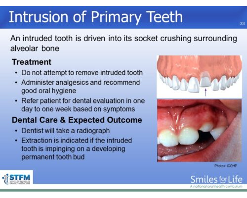 Module 4 Slide 33