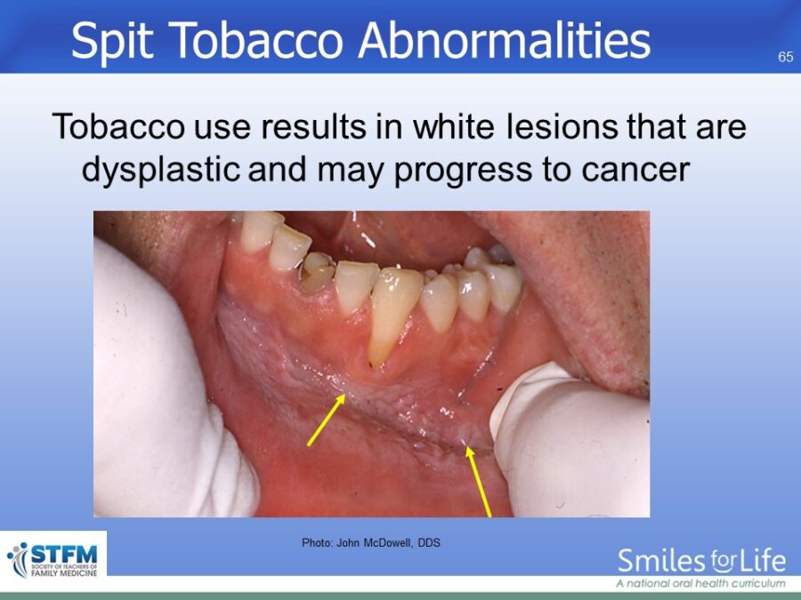 Module 7 Slide 65