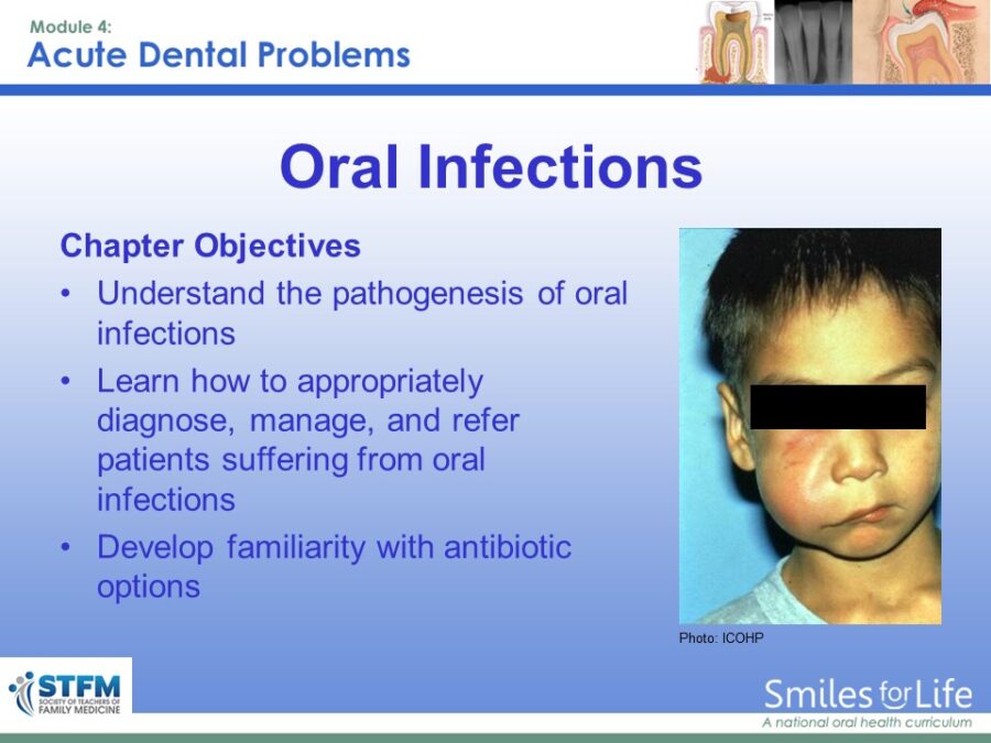 Module 4 Slide 11
