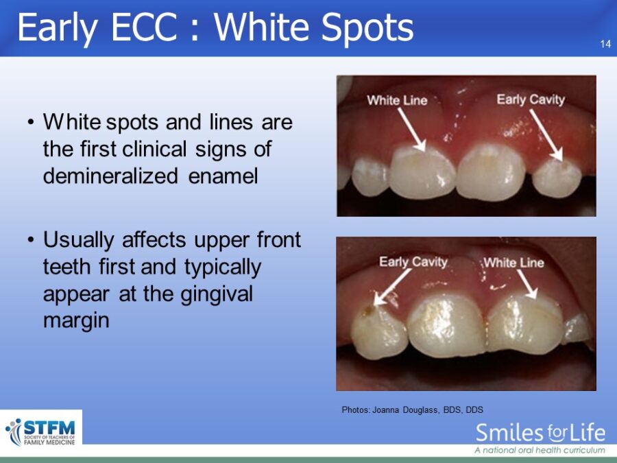 Module 6 Slide 14
