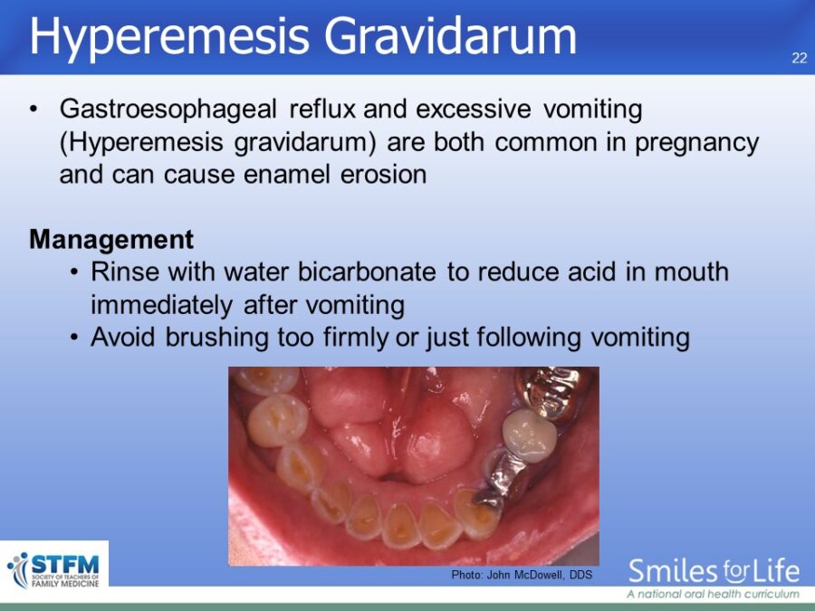 Module 5 Slide 22