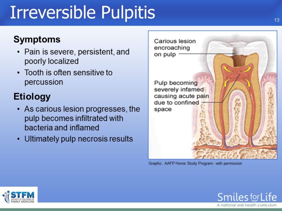 Module 4 Slide 13