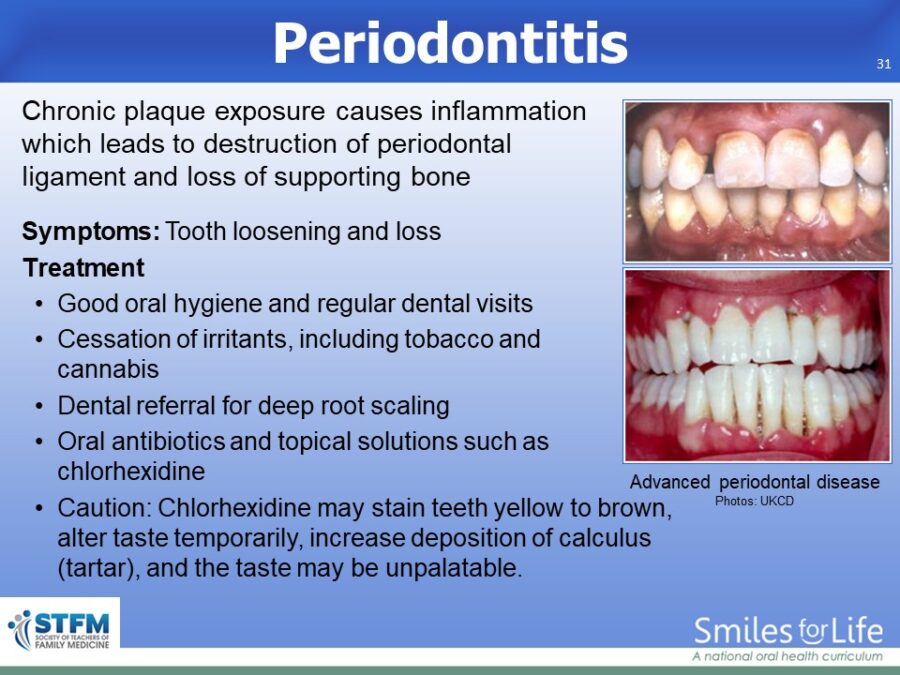 Module 8 Slide 31