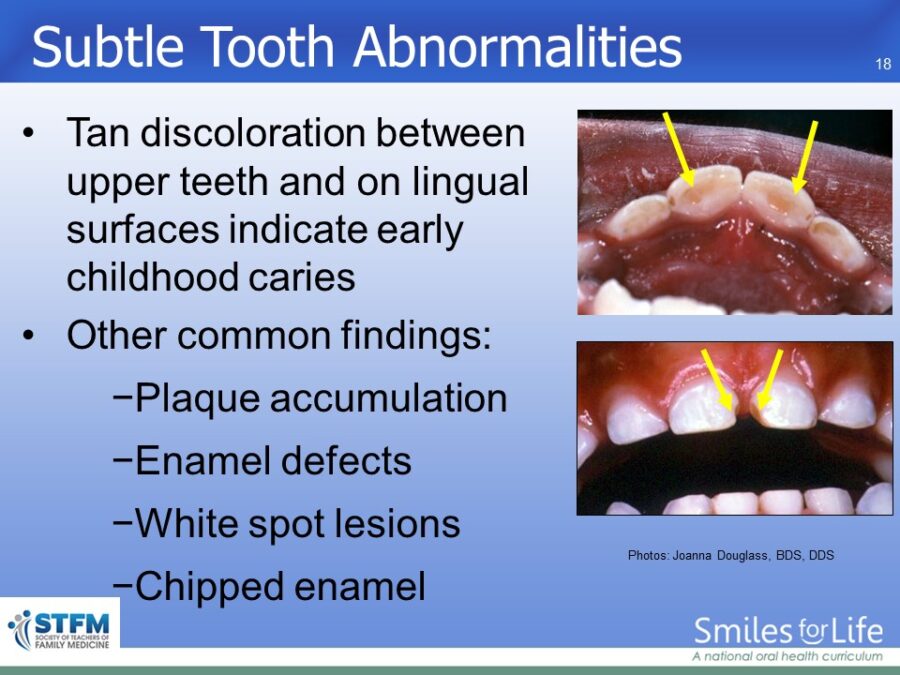 Module 7 Slide 18