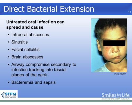 Module 1 Slide 18