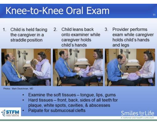 Module 6 Slide 11