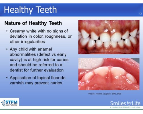 Module 6 Slide 12