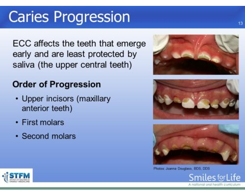 Module 6 Slide 13