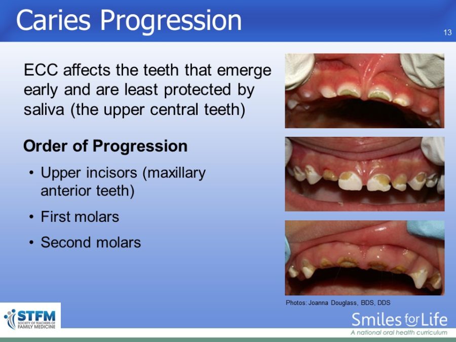 Module 6 Slide 13