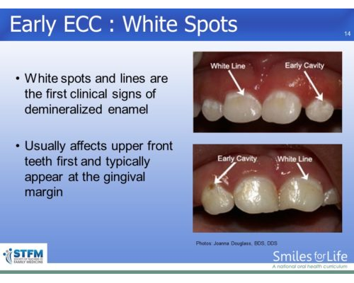 Module 6 Slide 14