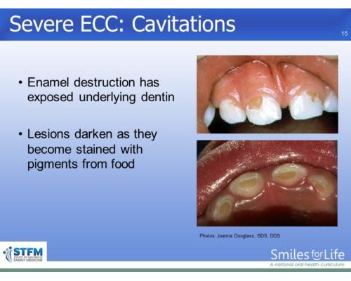 Module 6 Slide 15