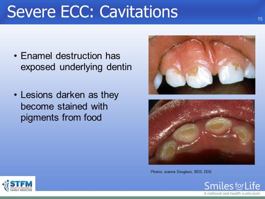 Module 6 Slide 15