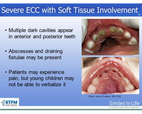 Module 6 Slide 16